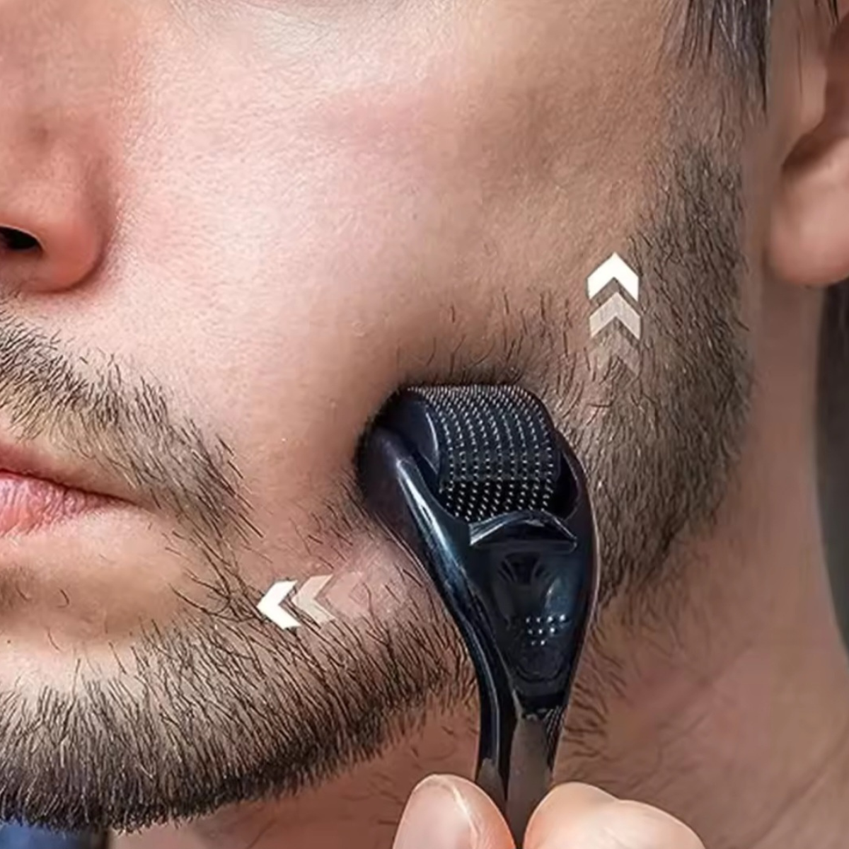 Derma Roller with 540 Micro Needles – For Skin, Hair & Beard Care