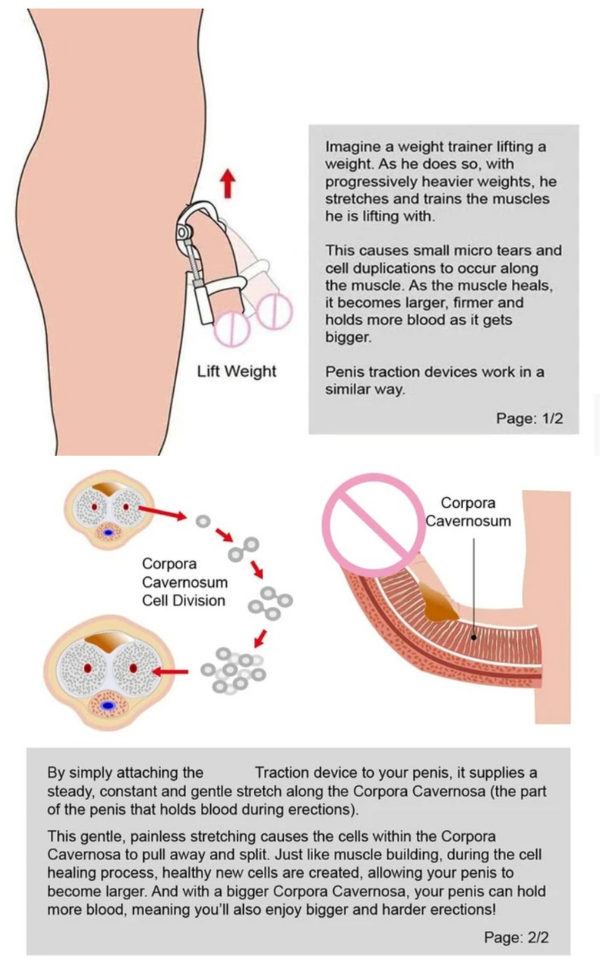 Penis Enlargement Stretcher