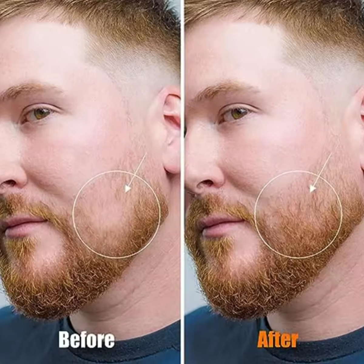 Derma Roller with 540 Micro Needles – For Skin, Hair & Beard Care